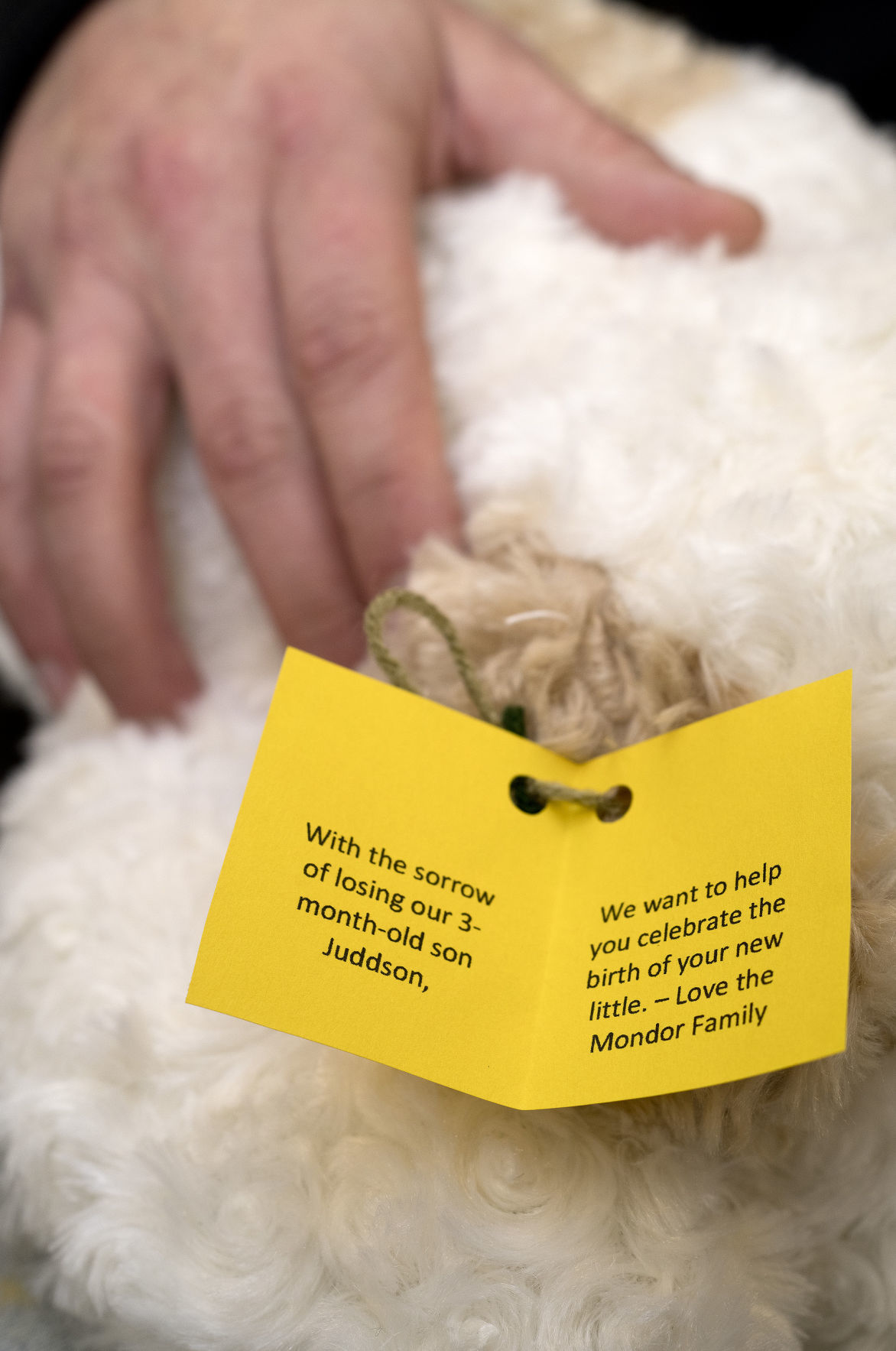 Sudden infant death syndrome